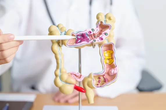 Tratamento para Síndrome do Intestino Irritável